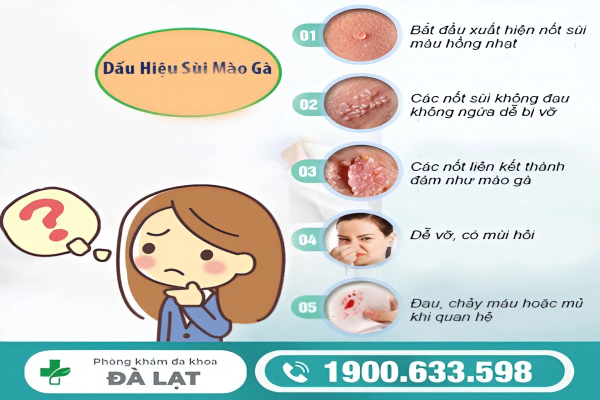 Xét nghiệm sùi mào gà ở nữ giới như thế nào ? 